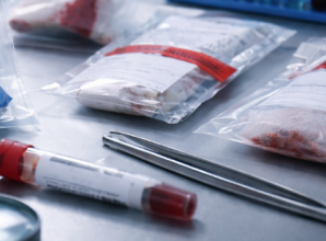 Archive picture of 'evidence' or forensics.